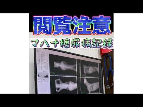 マハナ糖尿病記録　犬の発作(引き付け)の様子をご覧ください。