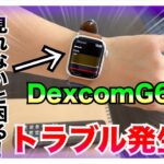 【糖尿病 Type1食事】持続型血糖測定器DexcomG6トラブル発生！TERUMOコールセンターに電話してみた！