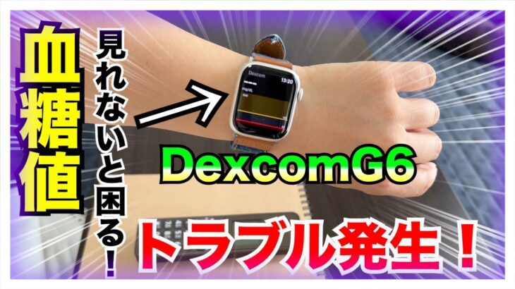 【糖尿病 Type1食事】持続型血糖測定器DexcomG6トラブル発生！TERUMOコールセンターに電話してみた！