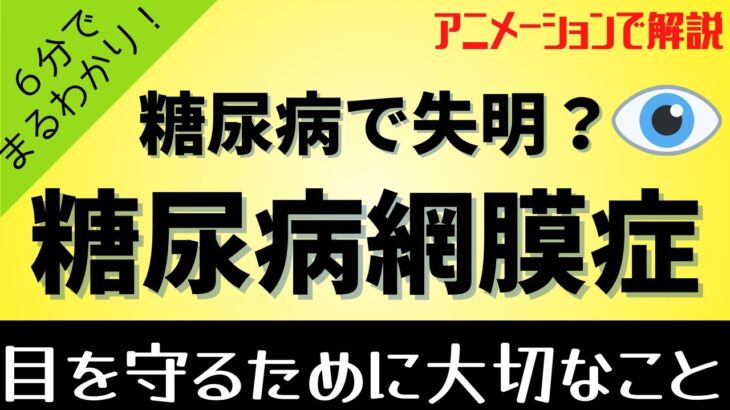 糖尿病で失明しないために！糖尿病網膜症の進行度３段階の網膜の様子と見え方、治療、予防についてアニメーションで解説します。眼科専門医監修で動画を作成しました。