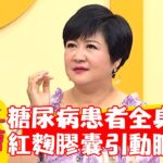 糖尿病患者莫名全身痠痛！竟是「紅麴膠囊」導致動脈硬化？！【#醫師好辣】20221010 part4 EP1428 宋明樺 黃彗倫