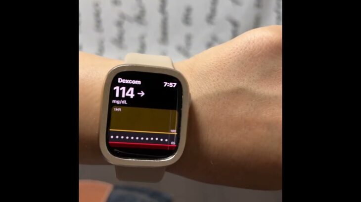 #shorts【糖尿病 Type1】超最新Apple Watch8は糖尿病の私の相棒♪毎朝する実測血糖値測定にも大活躍！【#shorts】