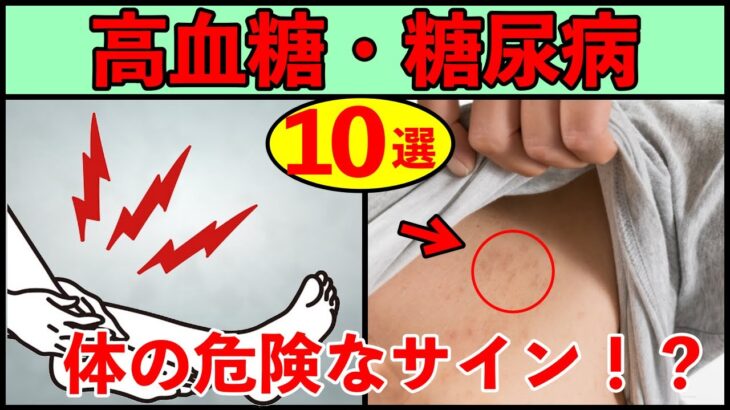 【糖尿病予防】血糖値が高いと体にでる危険なサイン１０選