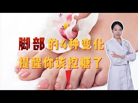 糖尿病患者注意：脚部出现这些变化，提醒你该控糖了