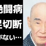 村田英雄の長い闘病生活、糖尿病を患い両足切断…「王将」や「無法松の一生」を歌った演歌歌手が壮烈な病状を背負い最後に残した偉業とは！？