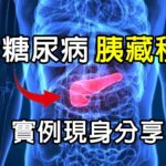 唯一治癒糖尿病辦法:【胰臟移植】，37歲做胰臟器官移植，完全擺脫掉胰島素與測血糖，個案親自分享他的實際經驗