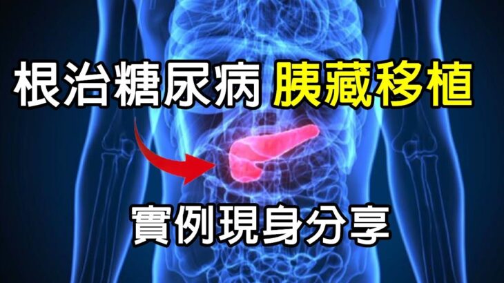 唯一治癒糖尿病辦法:【胰臟移植】，37歲做胰臟器官移植，完全擺脫掉胰島素與測血糖，個案親自分享他的實際經驗