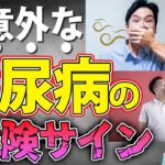 絶対に放置・見逃し厳禁！お口に現れる糖尿病の危険な症状とは？