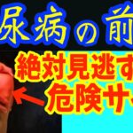 絶対に見逃してはいけない動脈硬化が進むと現れる糖尿病の要注意サイン5選！血糖値を下げる・HbA1cを下げる業務スーパーで買える最強の飲み物トップ５と飲んではいけないもの5選【ダイエット整体師 藤田】