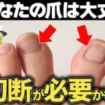 恐ろしい糖尿病の初期症状8選【ゆっくり解説】