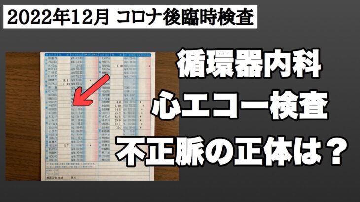 【コロナ後の不整脈】心エコー検査で分かったこと