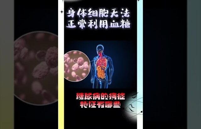 得了糖尿病的病症特征