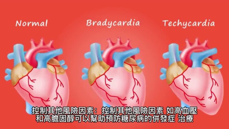 医生建议：如何逆轉糖尿病和控制？| 《逆轉糖尿病，不是不可能 》| #糖尿病