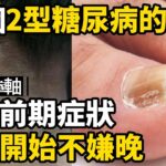 11個2型糖尿病的前期症狀 | 幫助逆轉糖尿病