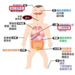 【動画】エキサイ健康教室 糖尿病について 2023年4月