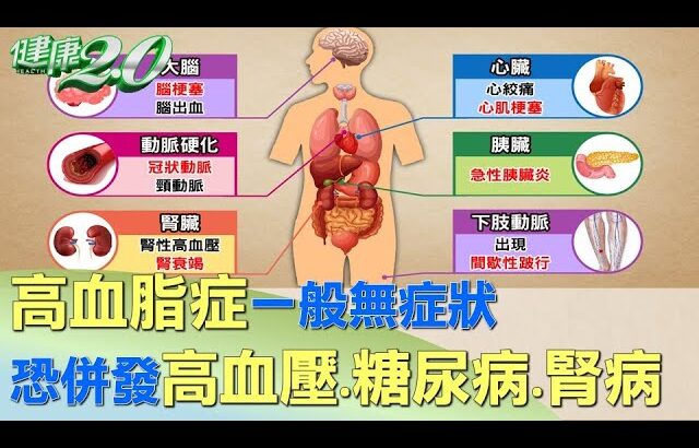 高血脂症一般無症狀 恐併發高血壓.糖尿病.腎病 健康2.0