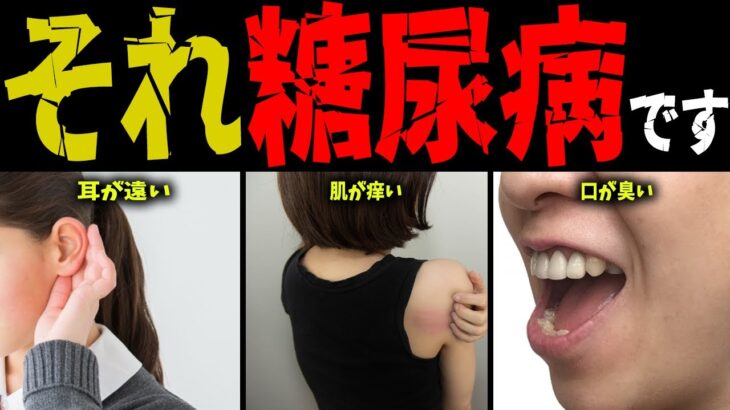 【危険】当てはまったらヤバい糖尿病のサイン5選【雑学】