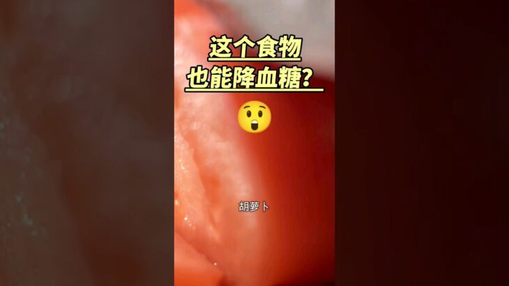 这个食物也能降血糖？糖尿病食物