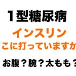 【１型糖尿病】インスリンはどこに打っていますか？お腹？腕？太もも？