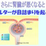 糖尿病性腎症について