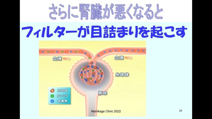 糖尿病性腎症について