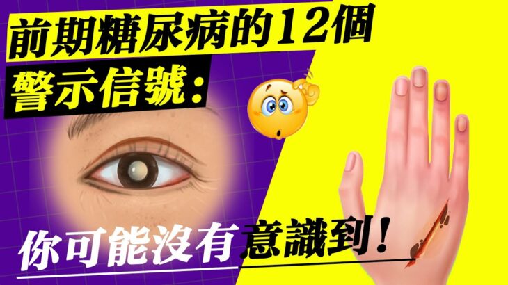 前期糖尿病的12個警示信號：你可能沒有意識到！12 Warning Signs of Prediabetes: You May Not Be Realizing It!