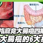 手指麻竟是大腸癌四期擴散 大腸癌的6大症狀! 年輕糖尿病患者當心大腸癌 好發期提前5年報到【健康2.0精選】