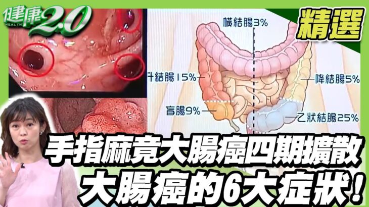 手指麻竟是大腸癌四期擴散 大腸癌的6大症狀! 年輕糖尿病患者當心大腸癌 好發期提前5年報到【健康2.0精選】