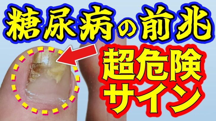 【見逃し厳禁！】恐ろしい糖尿病の超危険な９つサインを詳しく解説！