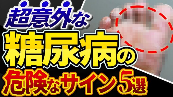 【放置厳禁！！】絶対見逃してはいけない糖尿病の危険な初期症状5選について医師が解説しました。