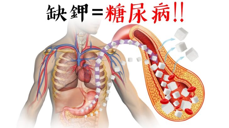 缺钾导致糖尿病,柏格医生dr berg