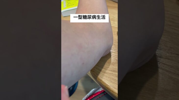 一型糖尿病生活　#一型糖尿病