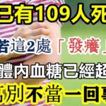 糖尿病人註意了！一周已有109人死亡！身上若這2處「發癢」，說明體內血糖已經超標！千萬別不當一回事！