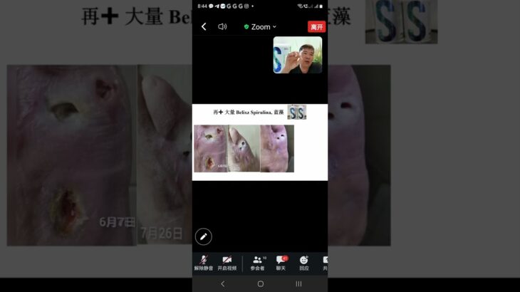 Belixz蓝藻线上见证：甲型糖尿病患者。