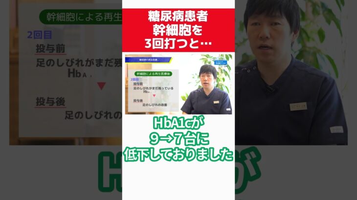 糖尿病患者に幹細胞を３回打った結果 #sohrts