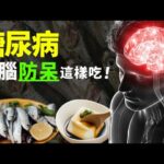 糖尿病可以吃的食物，保護大腦可以吃的食物！