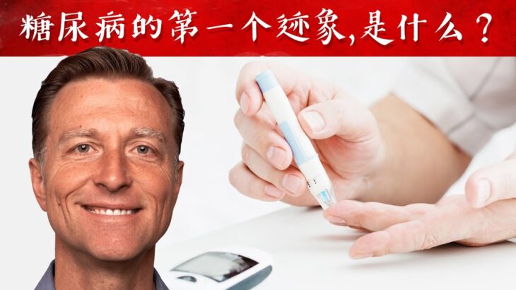 出现糖尿病的第一个迹象，怎么做？自然疗法,柏格医生dr berg