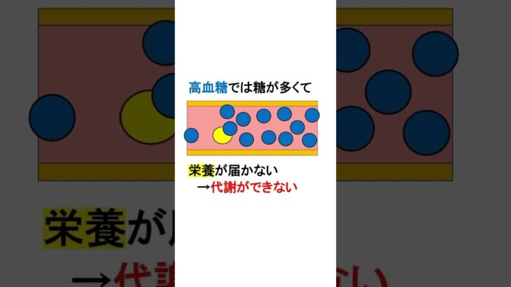 糖尿病はなぜ恐ろしい？#必修#国試対策