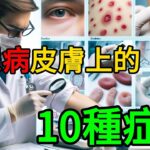 🩺 糖尿病皮膚上的10種症狀 😷