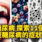 🩺 糖尿病 探索11個2型糖尿病的症狀！