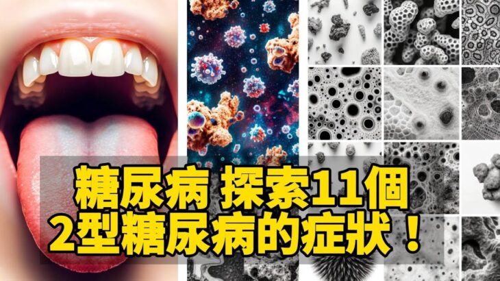 🩺 糖尿病 探索11個2型糖尿病的症狀！