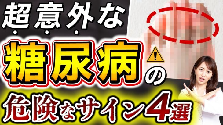 【放置厳禁！】絶対見逃してはいけない糖尿病の危険な初期症状4選とは？皮膚の状態から分かる初期症状について解説