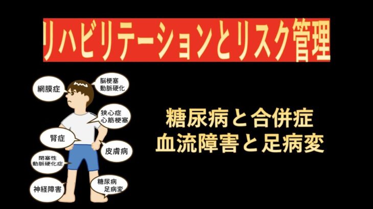 リハビリテーションリスク管理-糖尿病の合併症と足病変（末梢神経障害、閉塞性動脈硬化症）