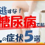 見逃さないで！糖尿病で起こる、足からのサイン５選！【内科医が解説】