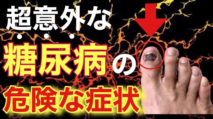 【放置厳禁①】知らないうちに糖尿病が進行している危険な症状とは？