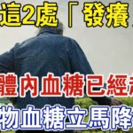 身上若2處「發癢」，說明體內血糖已經超標！糖尿病最怕的食物，血糖立馬降下來，千萬別忽視 | 中老年驛站