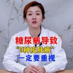 糖尿病导致“5种皮肤病”一定要重视！