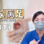 糖尿病足(下)——糖足的诊断、治疗及预防||Diagnosis, treatment, and prevention of diabetic foot