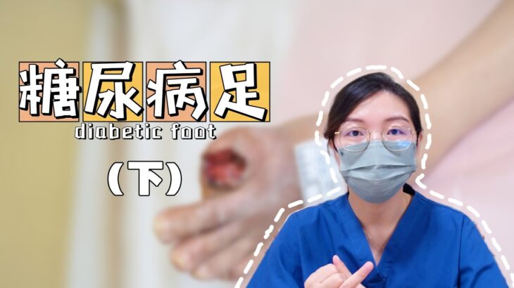 糖尿病足(下)——糖足的诊断、治疗及预防||Diagnosis, treatment, and prevention of diabetic foot