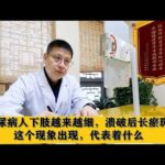 糖尿病人下肢越来越细，溃破后长瘀斑，这个现象出现，代表着什么